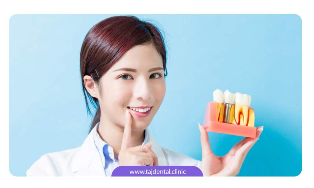 متخصص ایمپلنت در حال توضیح عواملی که موجب کاهش طول عمر ایمپلنت دندان می شود