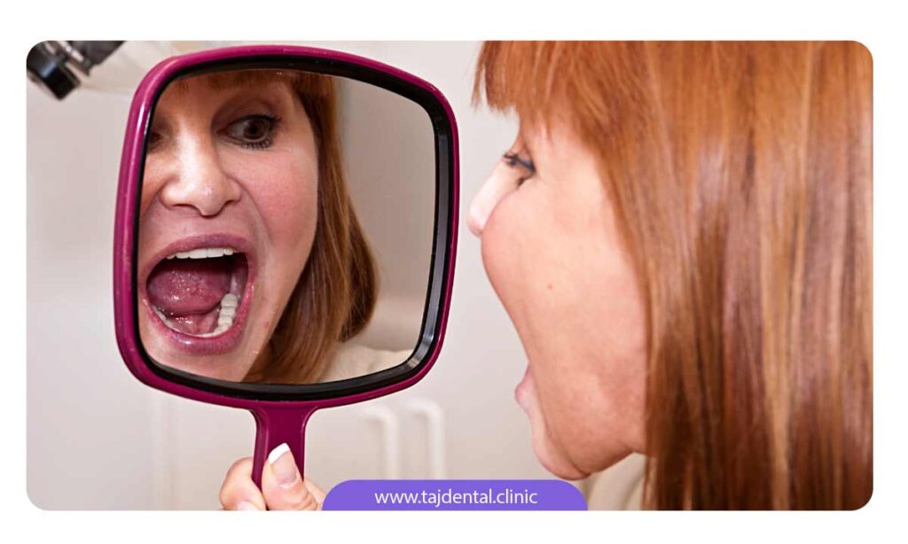 تصویر خانمی میانسال که به دندان های خود در آینه نگاه می کند