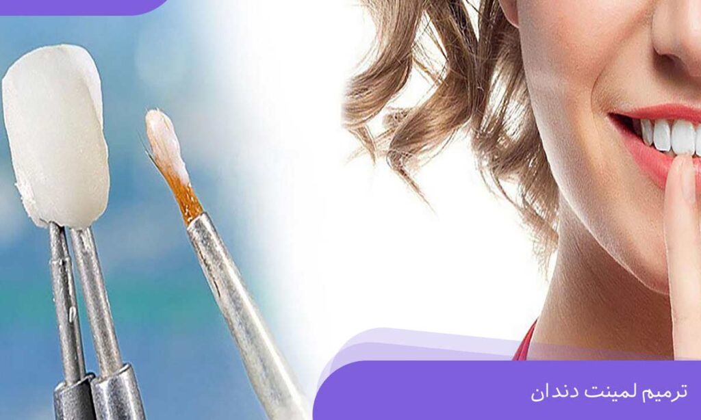 ترمیم لمینت دندان