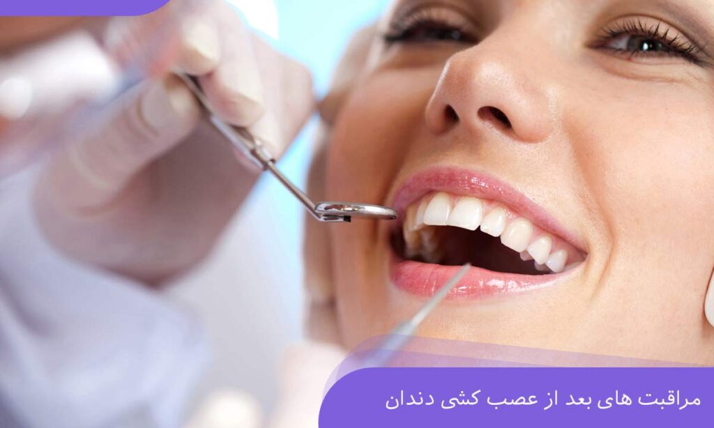 مراقبت های بعد از عصب کشی دندان