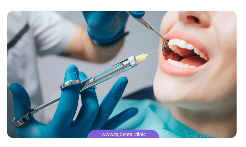 تصویر دندانپزشک در حال تزریق بی حسی برای اتجام درمان ریشه دندان