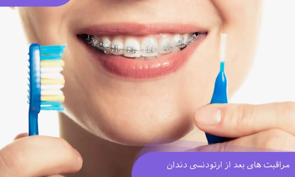 مراقبت های بعد از ارتودنسی دندان