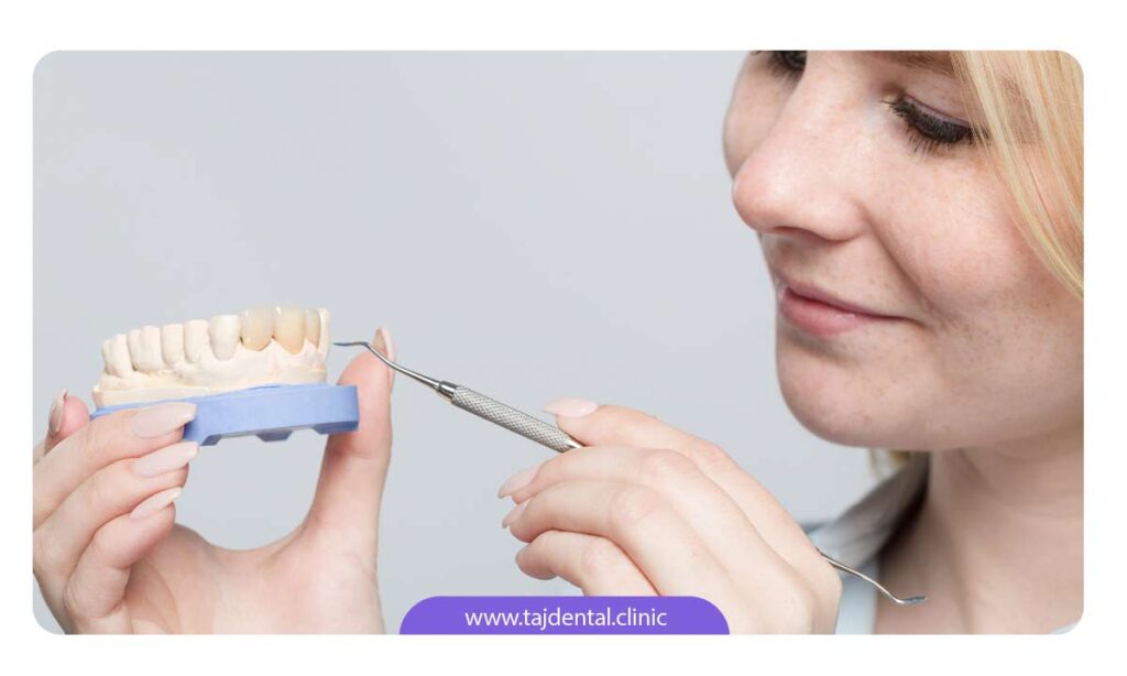 تصویر دندانپزشک در حال اشاره به ماکتی از روکش دندان