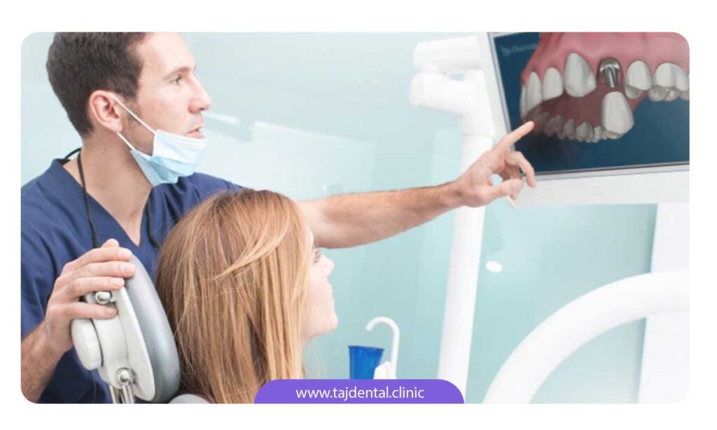 تصویر دندانپزشک و بیمار در حال بحث در مورد ایمپلنت دندان
