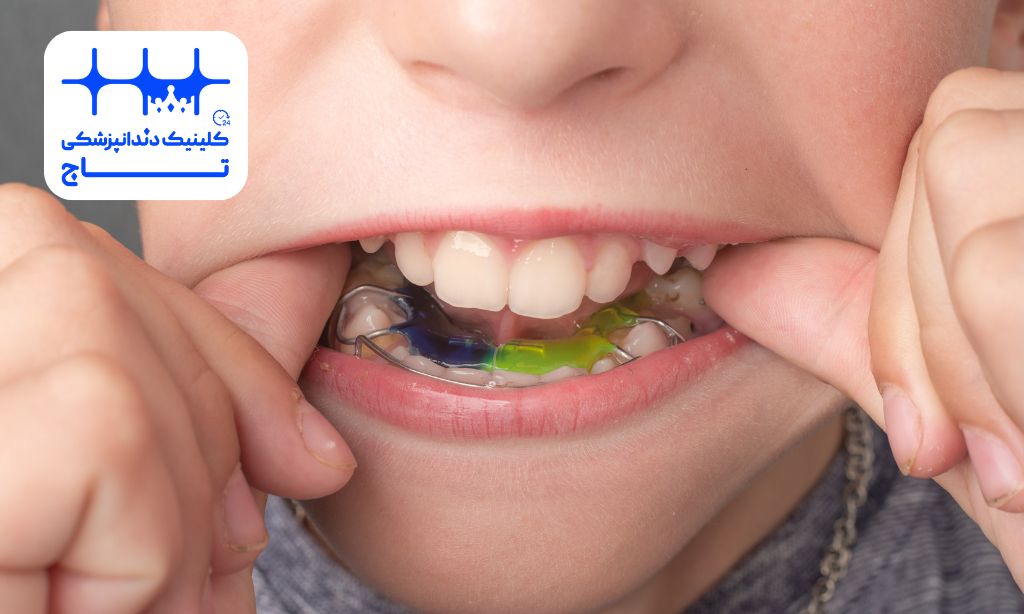 ارتودنسی فک پایین