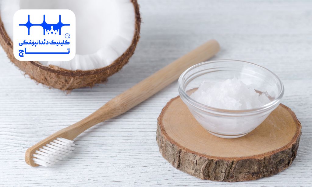 روغن نارگیل برای دندان