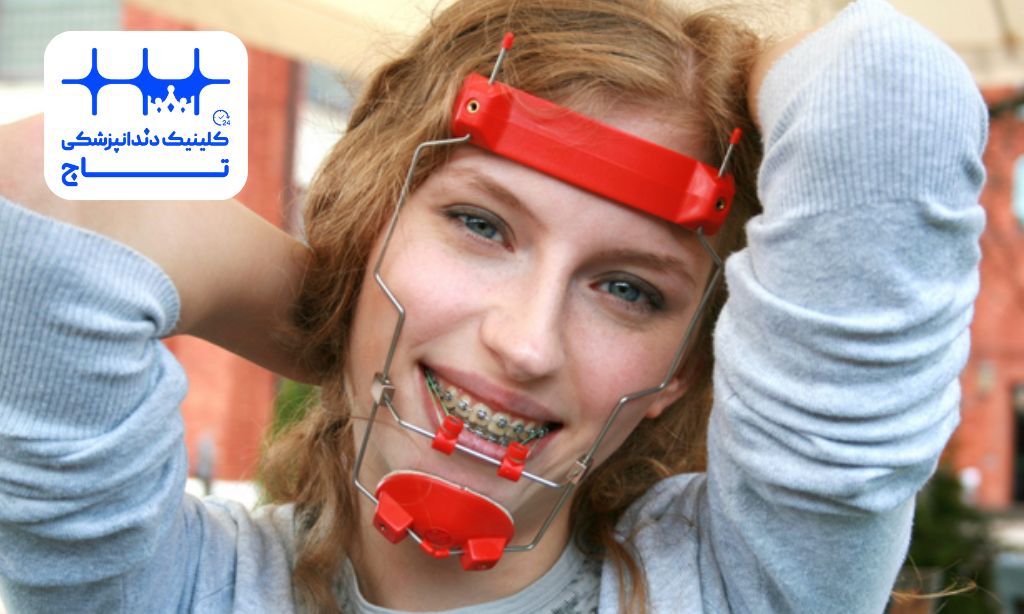 فیس ماسک ارتودنسی