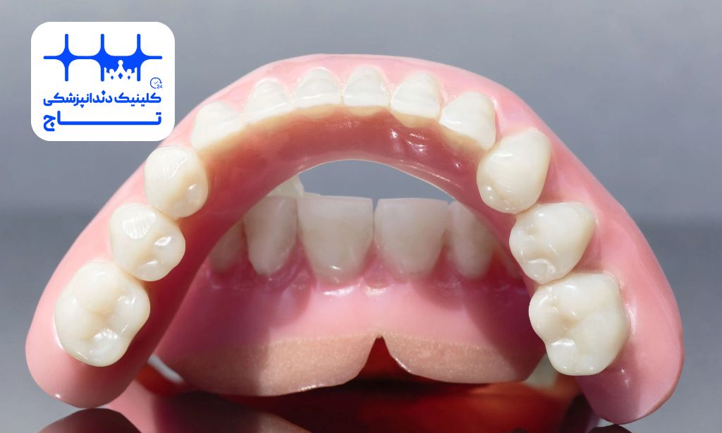 پروتز دندان بدون کام