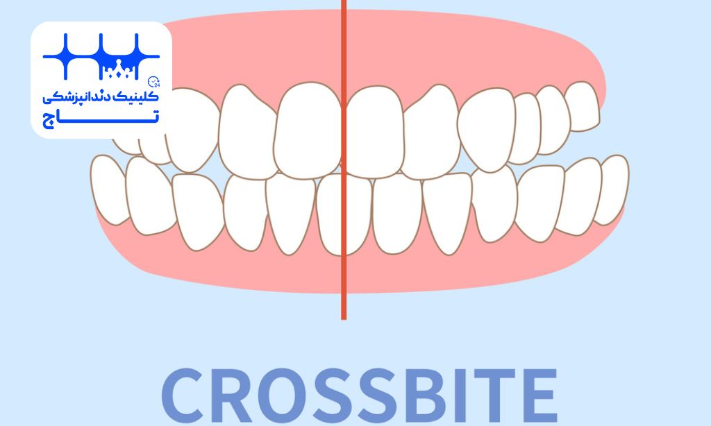 کراس بایت