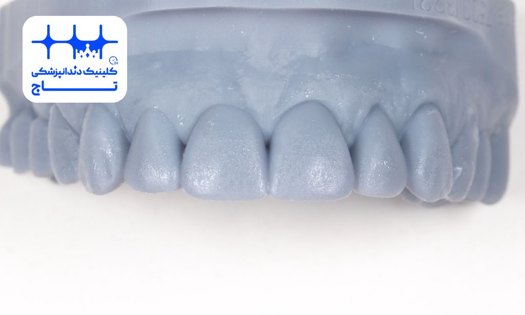 موکاپ دندان چیست